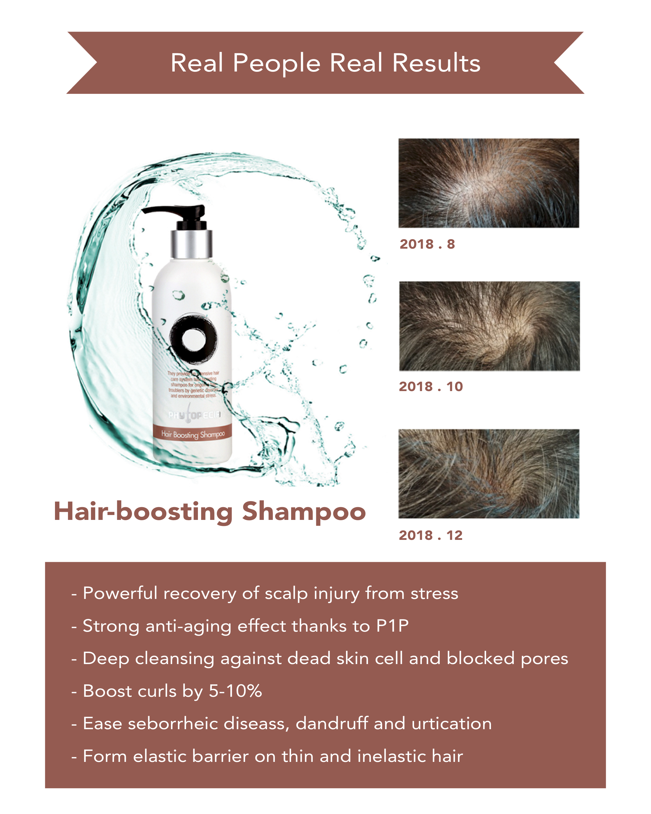 How to reverse hair loss? Find out what we recommend!