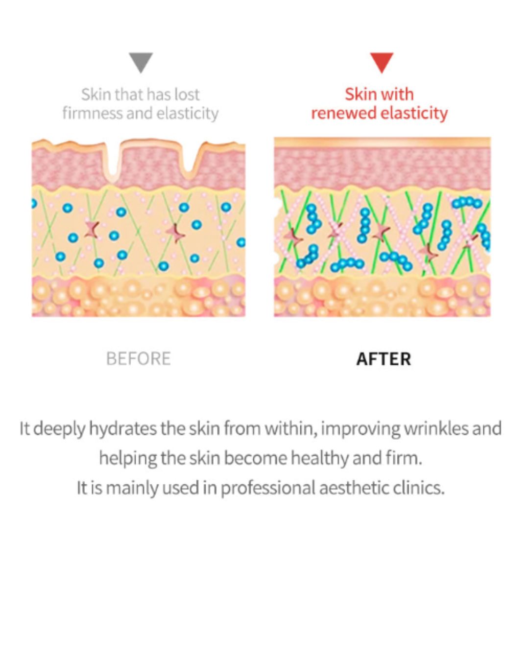 Dermaline PDX5 Skin Booster Total Solution (5ml x 5)