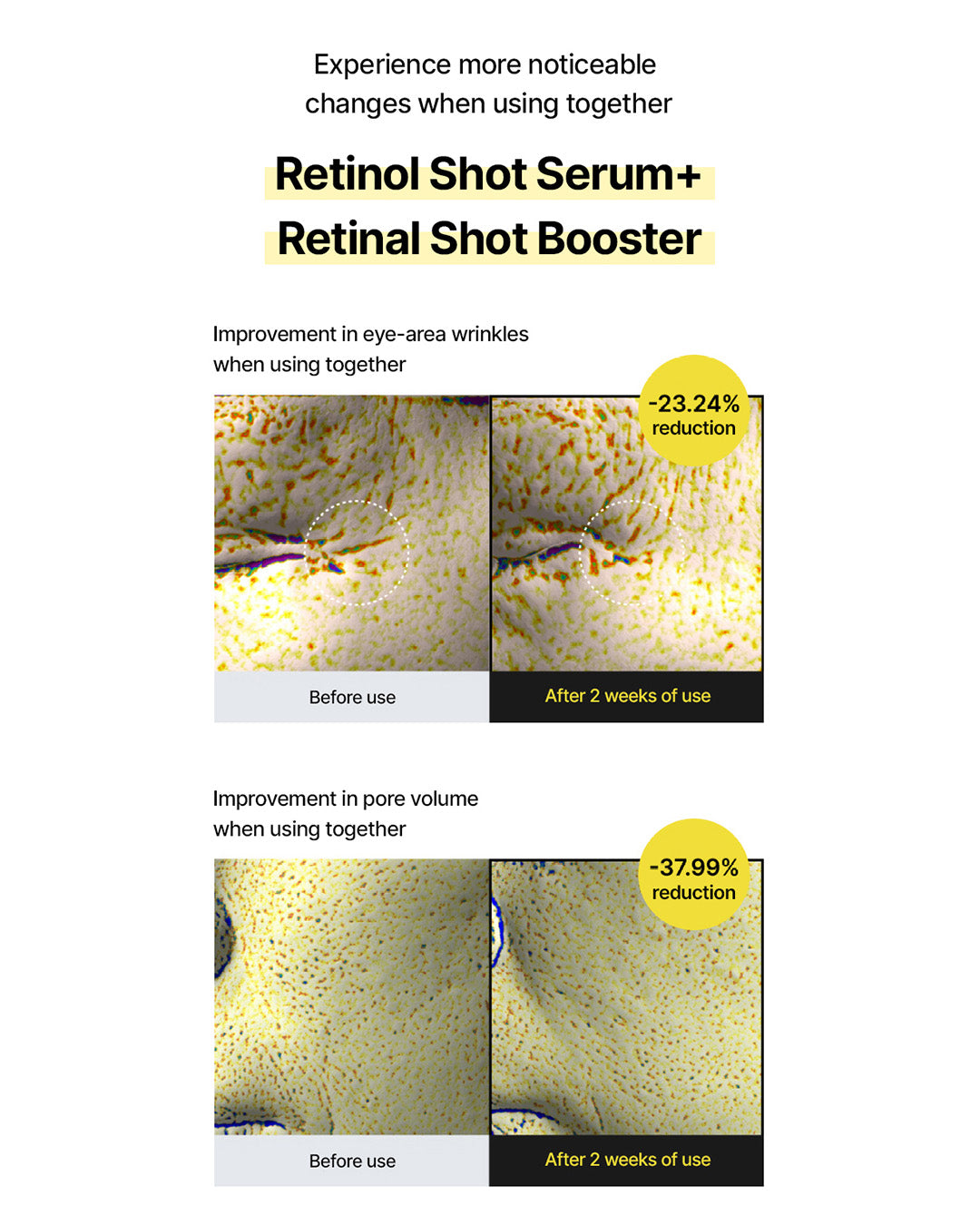 celimax the Vita-A Retinol Shot Tightening Serum