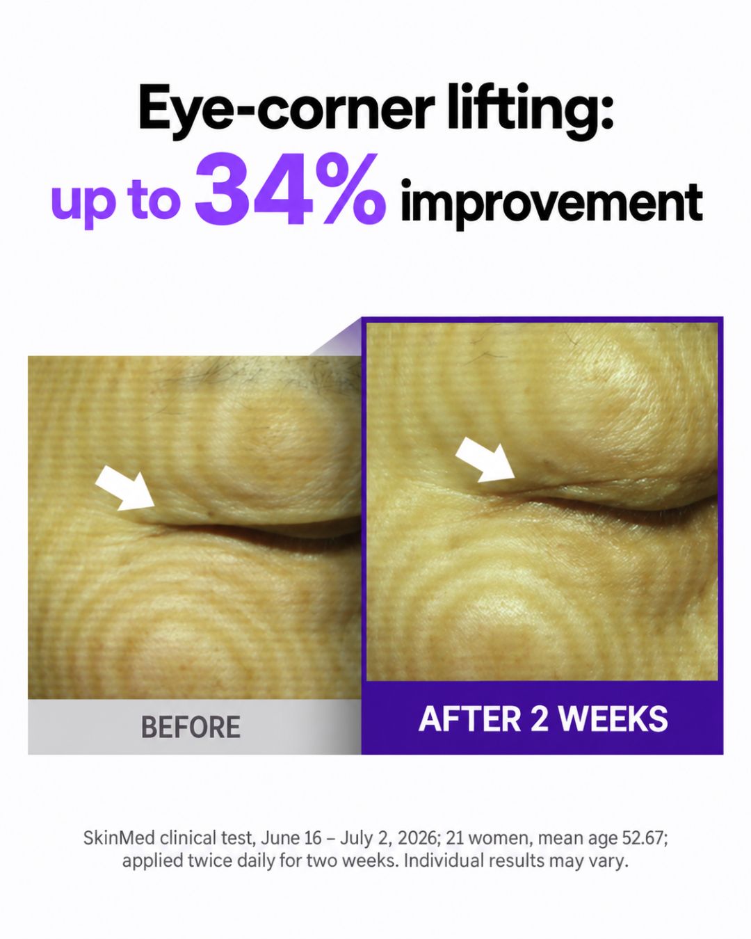 [PROMO] Lavien Volumizing Eye Lifting Cream