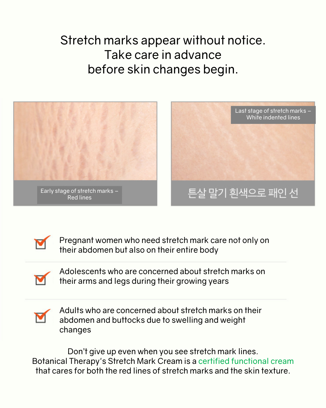[PROMO] Botanical Therapy Stretch Cream (for stretch marks)
