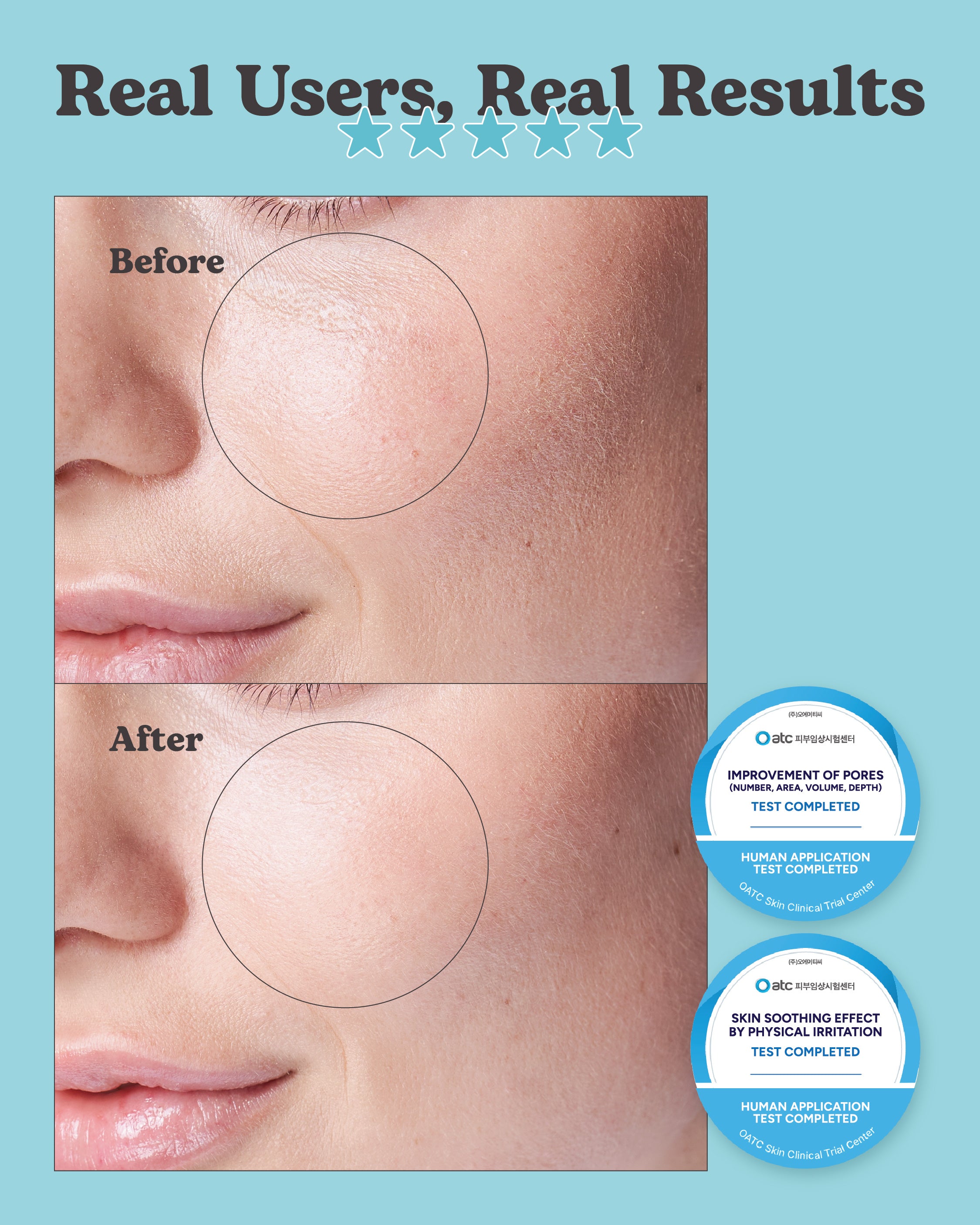 Jung Beauty CO2 Pore Deep Cleansing Mask For Face & Neck