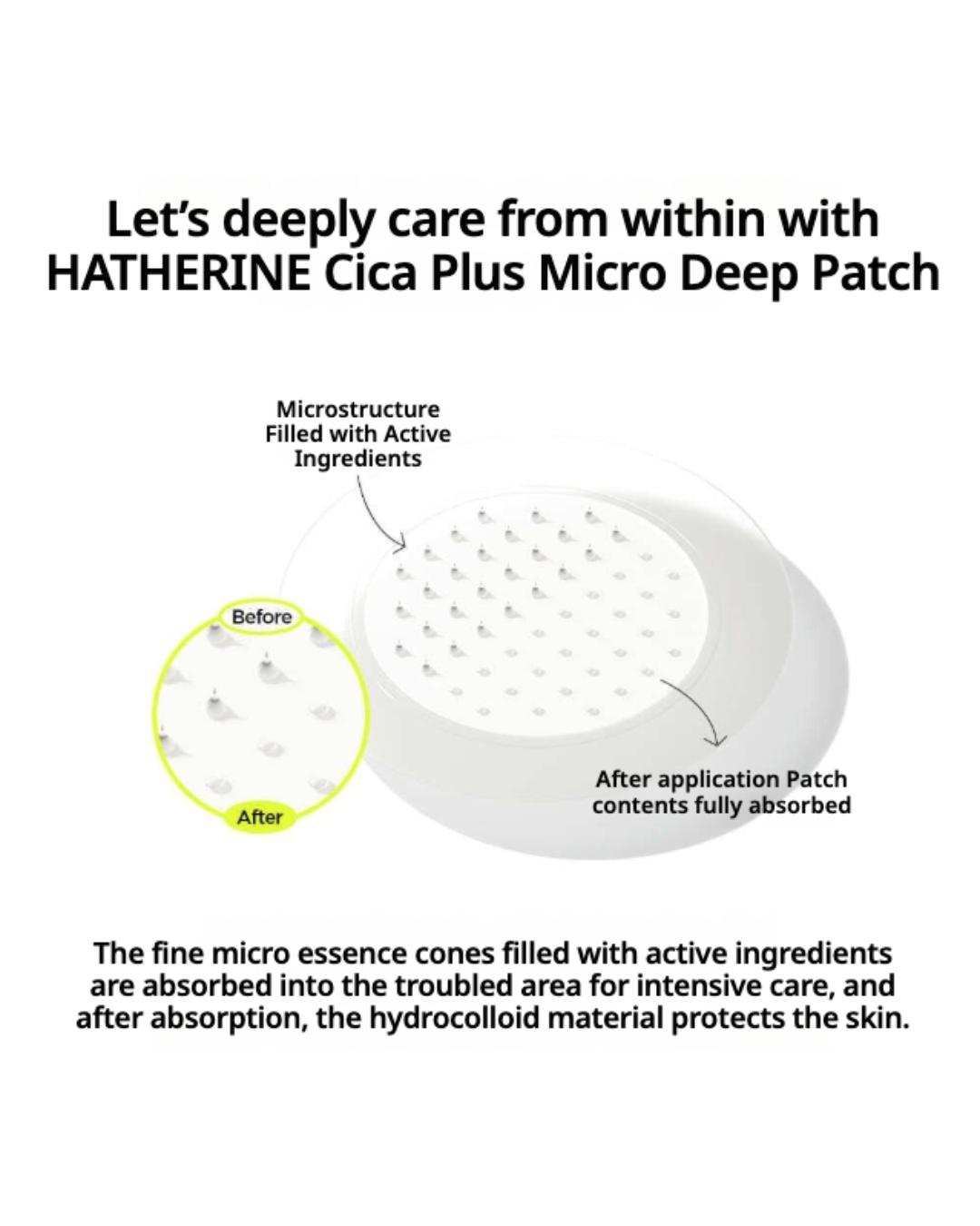 [PROMO] Hatherine Cica + Micro Deep Patch (9 patches)