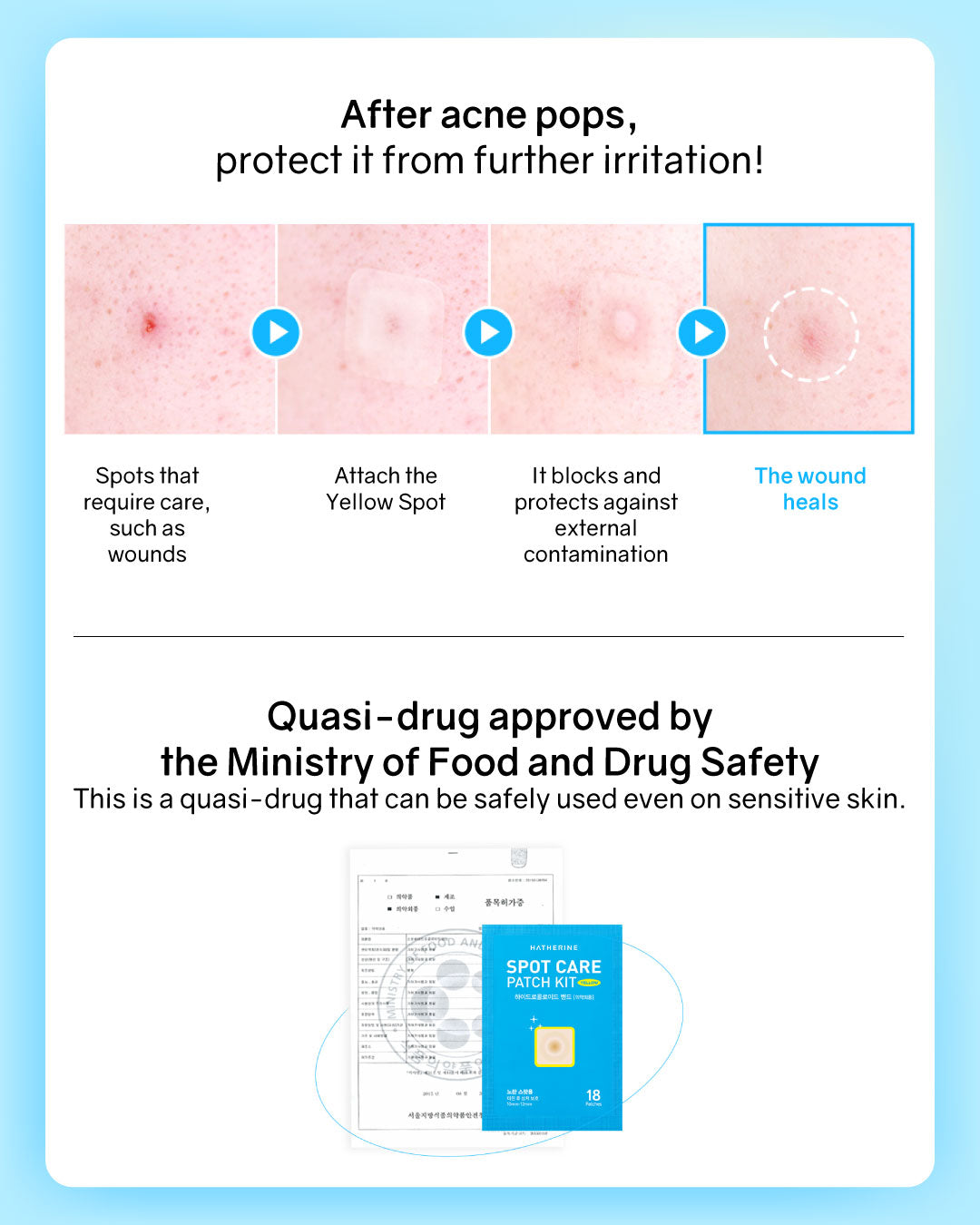 [PROMO] Hatherine Spot Care Patch Kit (76 patch)
