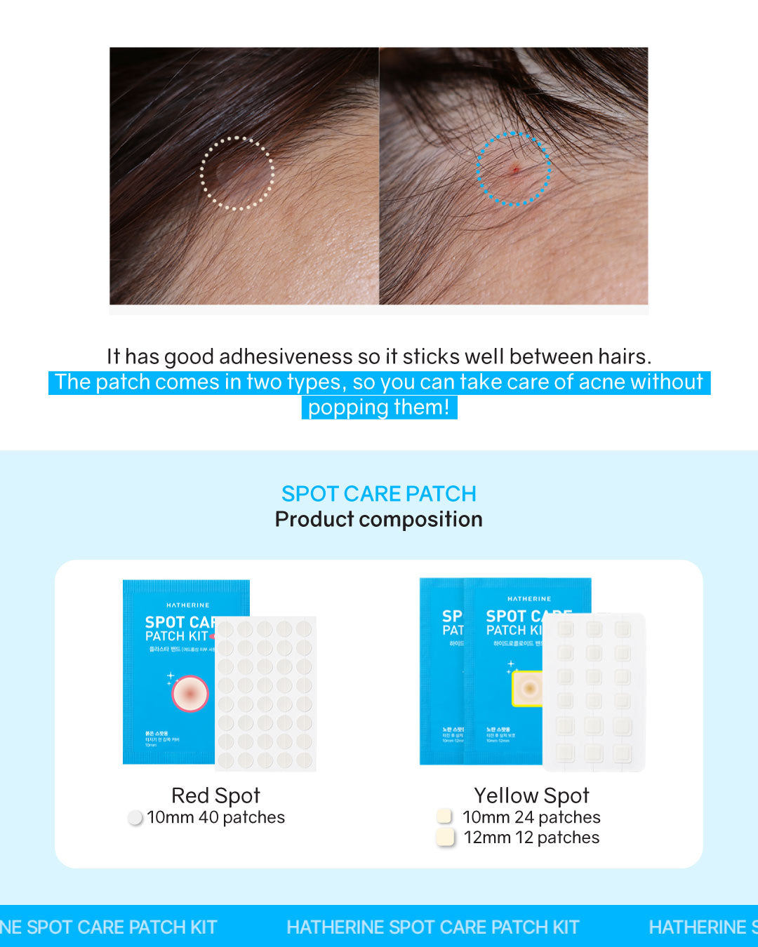 [PROMO] Hatherine Spot Care Patch Kit (76 patch)