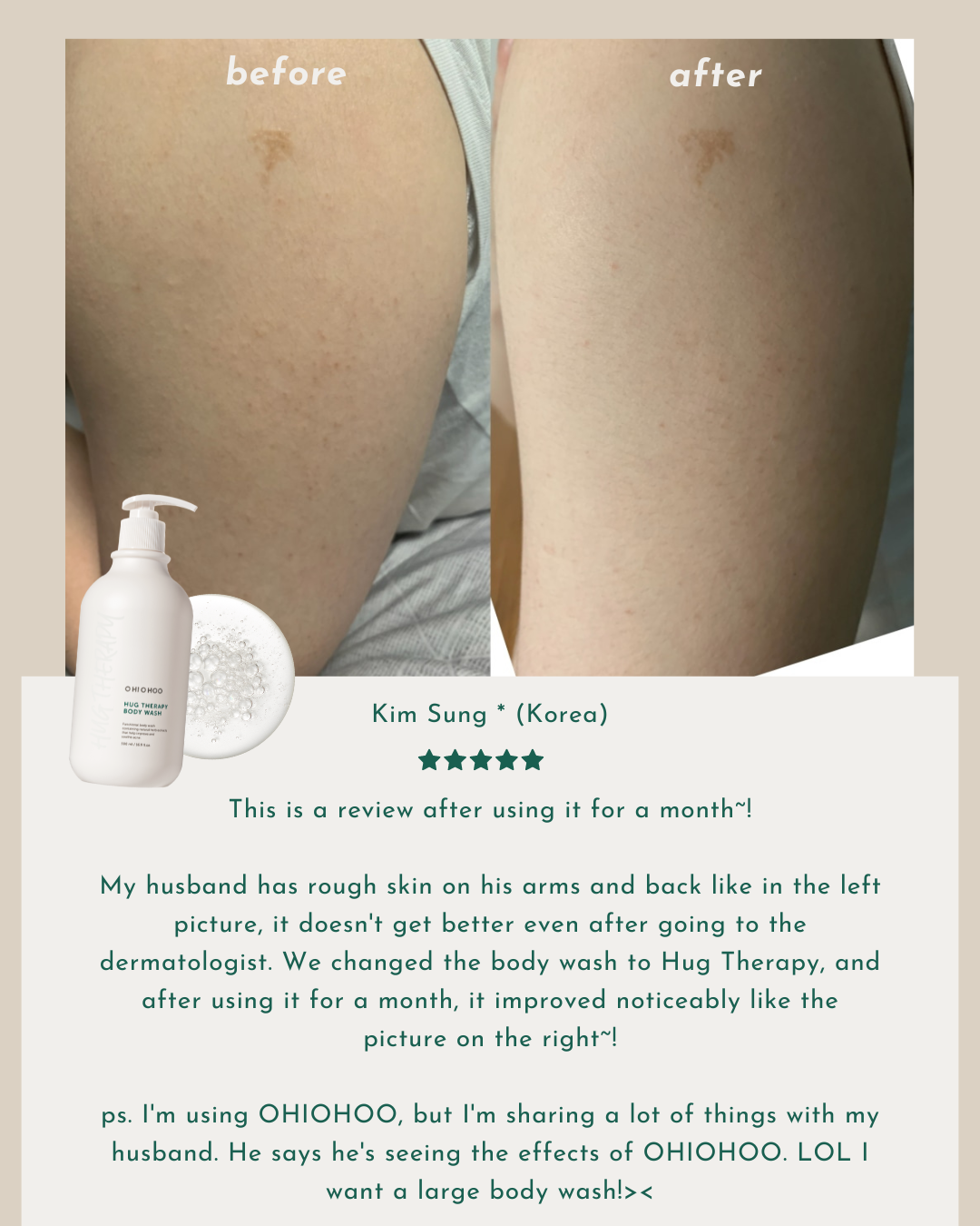 [PROMO] OHIOHOO Hug Therapy Body Duo