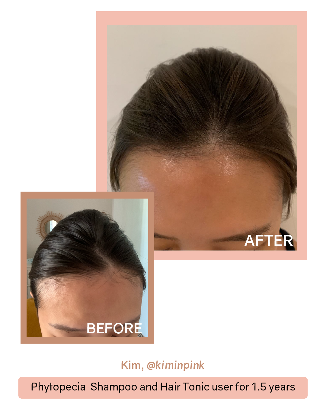 [PROMO] Phytopecia+ Hair Boosting Shampoo / Hair Tonic / Scalp Essence / PDRN Scalp Ampoule