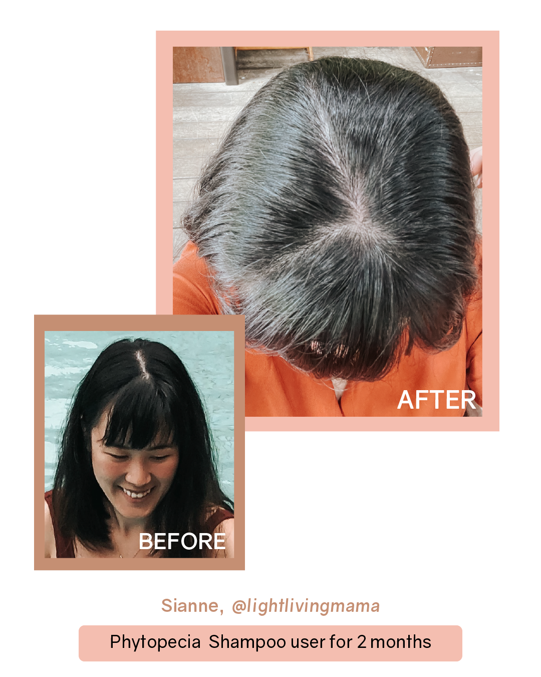 [PROMO] Phytopecia+ Hair Boosting Shampoo / Hair Tonic / Scalp Essence / PDRN Scalp Ampoule