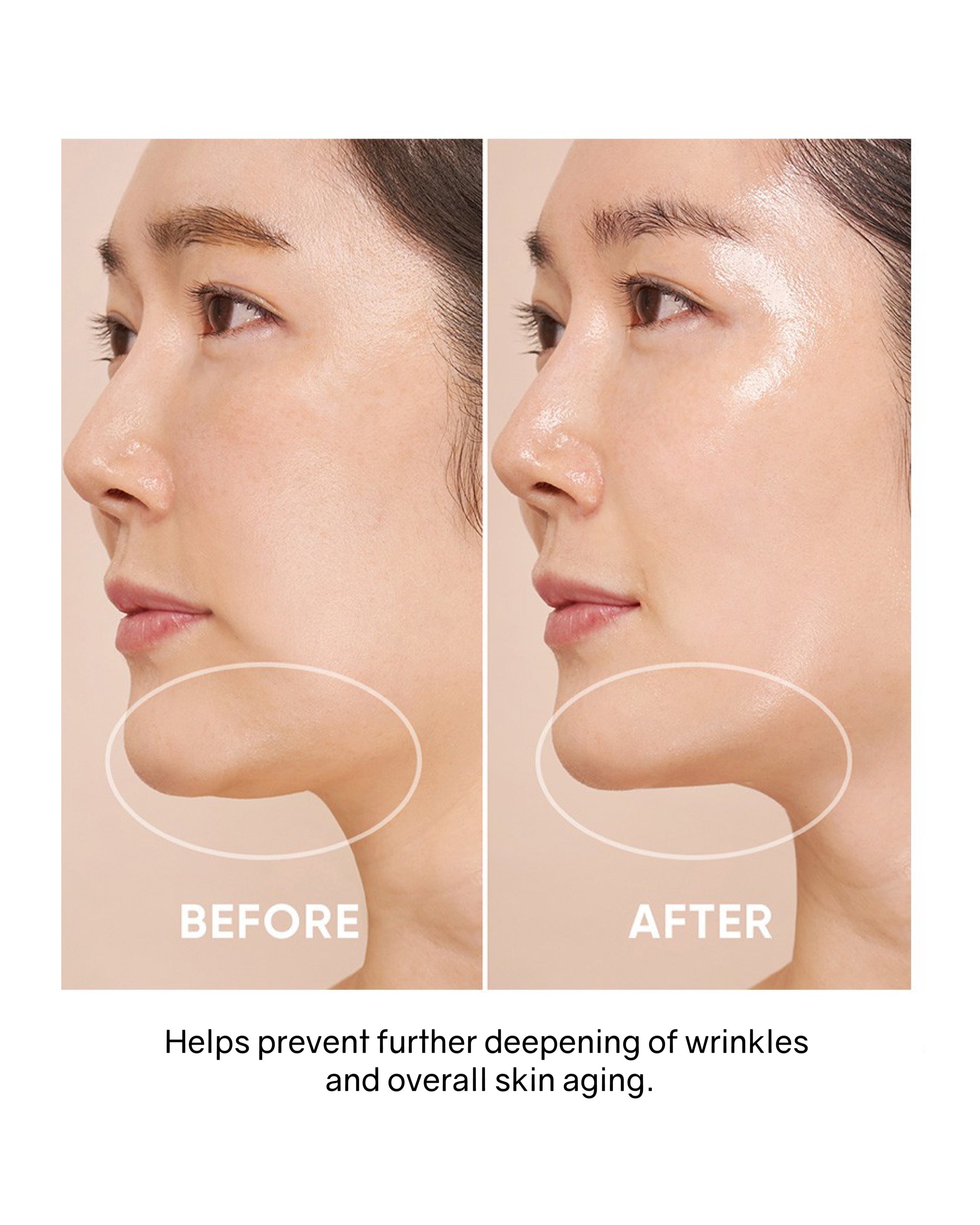 [Online Exclusive] OHIOHOO Pro Collagen Lift Kit