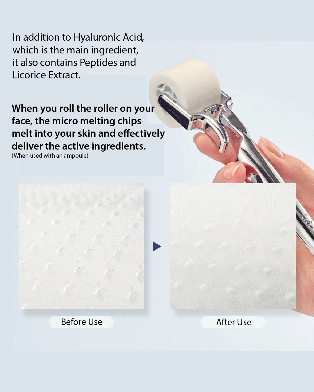[PROMO] Lavien 4000 Micro Shot Skin Roller